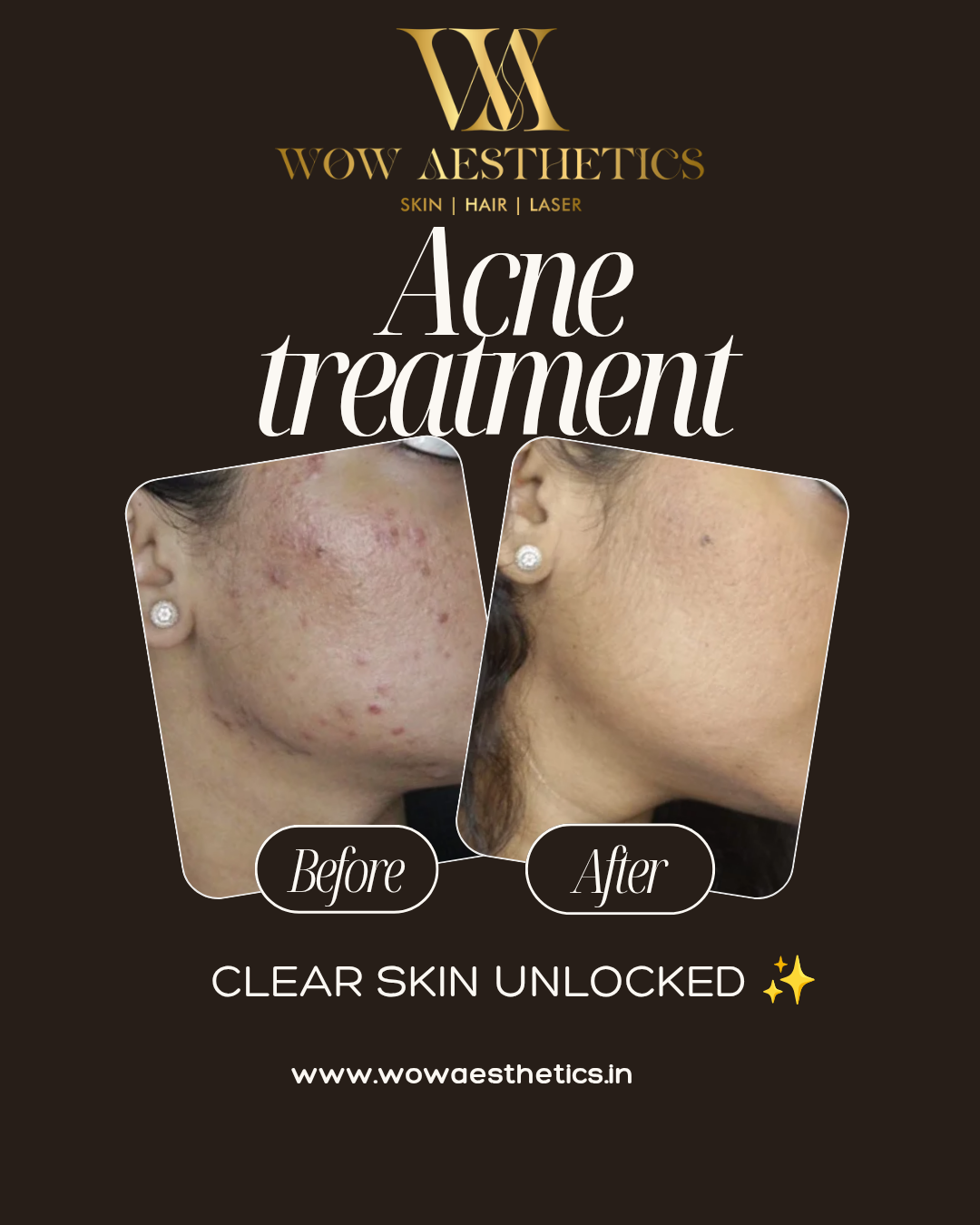 Dark Brown and White Typographic Skincare Treatment Instagram Post_20251023_180122_0000