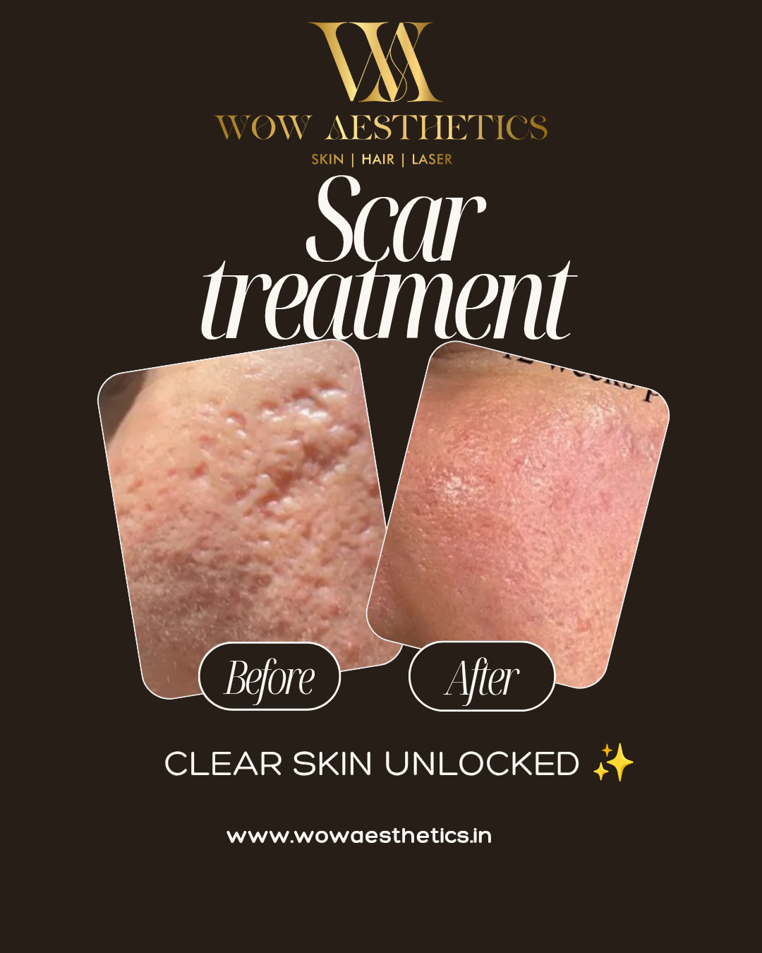 Dark Brown and White Typographic Skincare Treatment Instagram Post_20251028_174209_0000