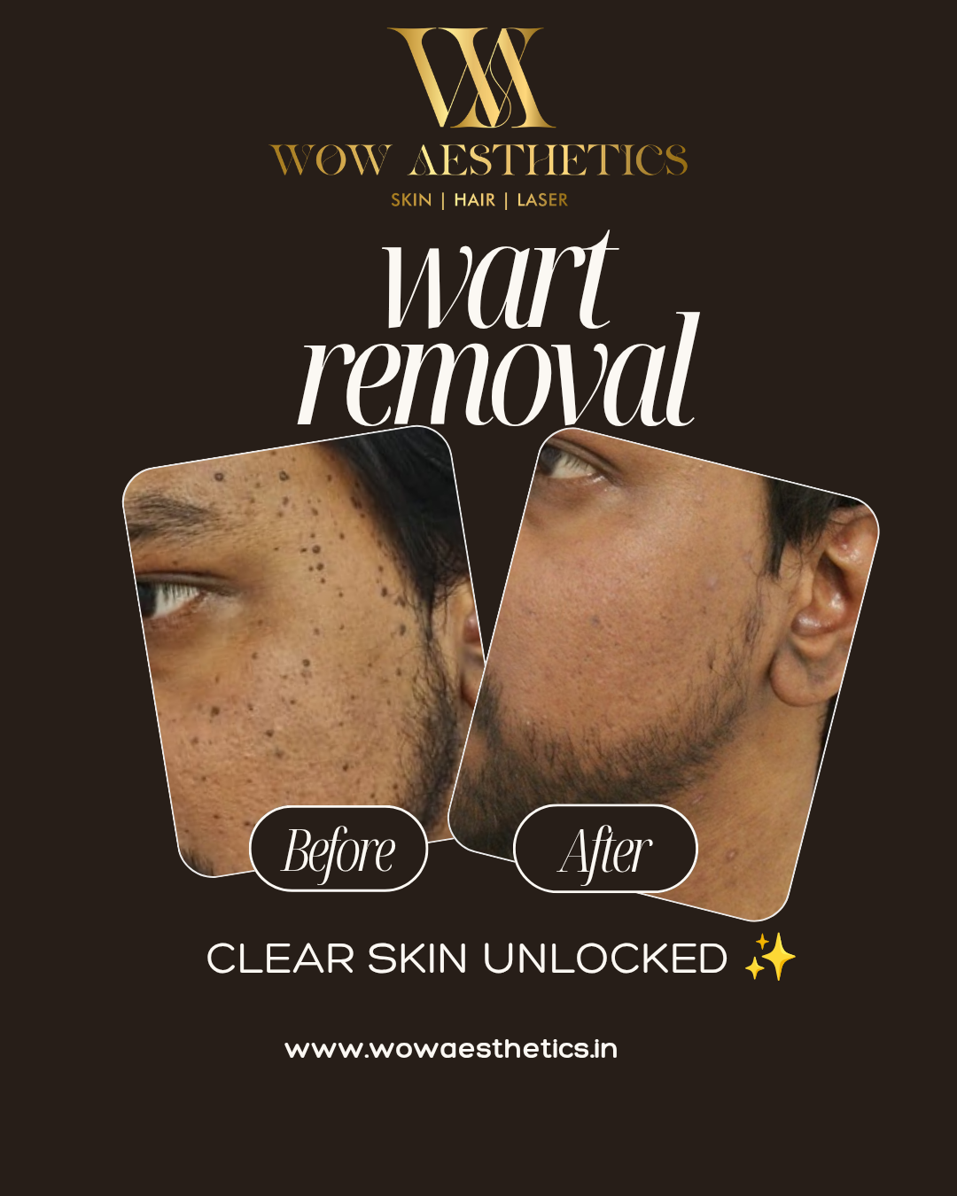 Dark Brown and White Typographic Skincare Treatment Instagram Post_20251128_151537_0000