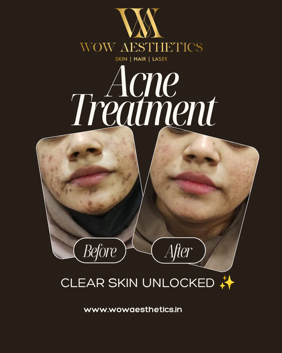 Dark Brown and White Typographic Skincare Treatment Instagram Post_20251128_151752_0000