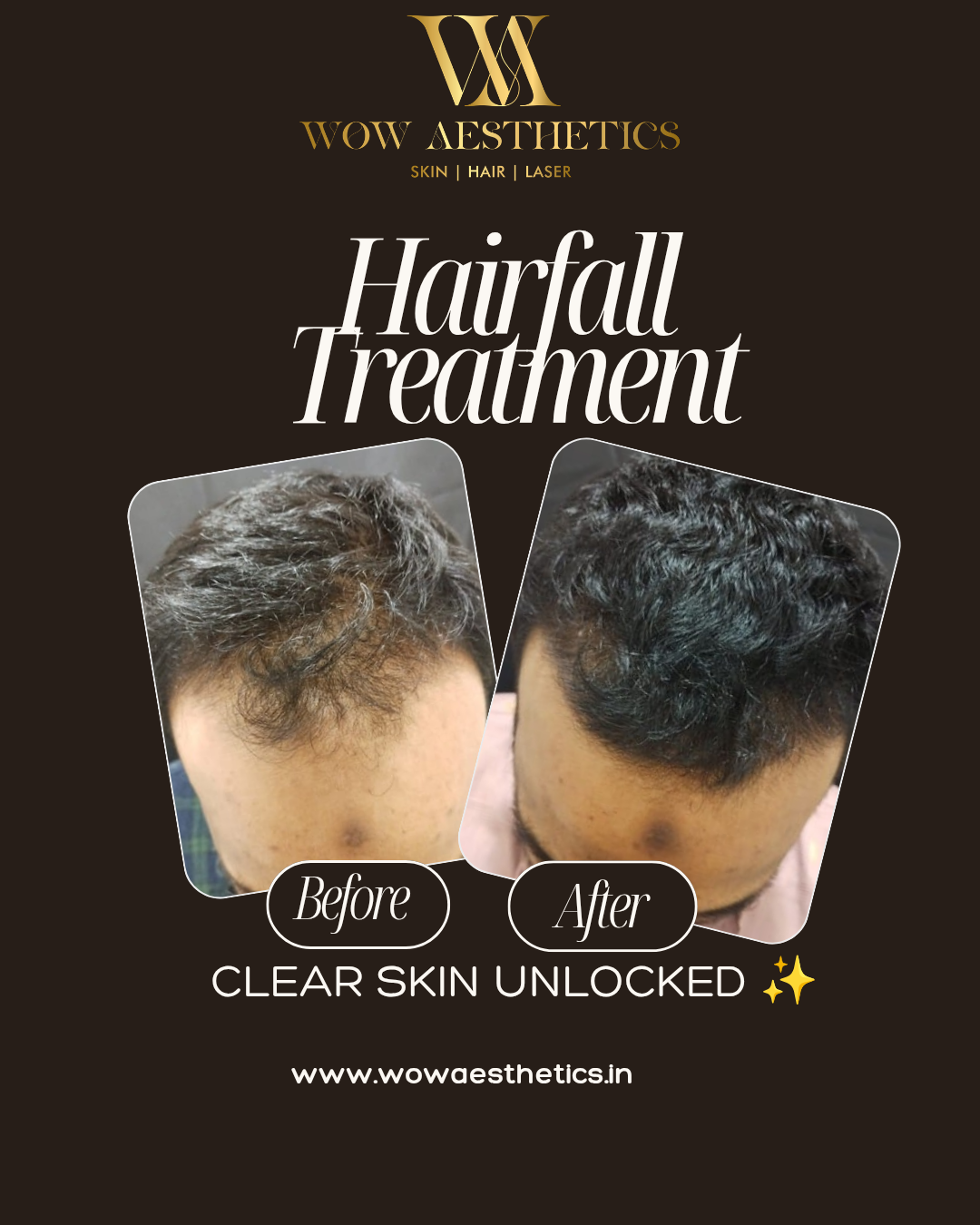 Dark Brown and White Typographic Skincare Treatment Instagram Post_20251128_151944_0000