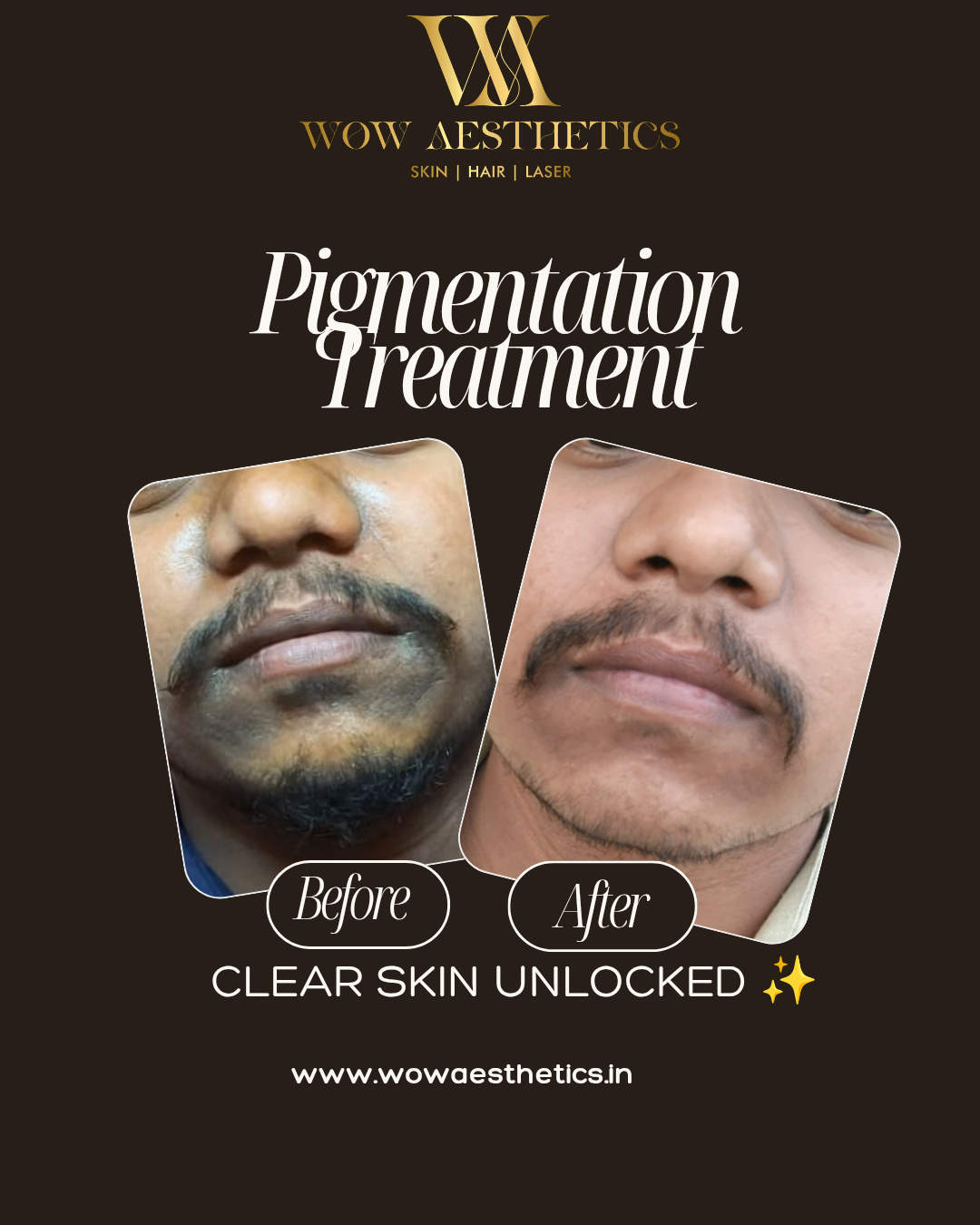 Dark Brown and White Typographic Skincare Treatment Instagram Post_20251128_152121_0000