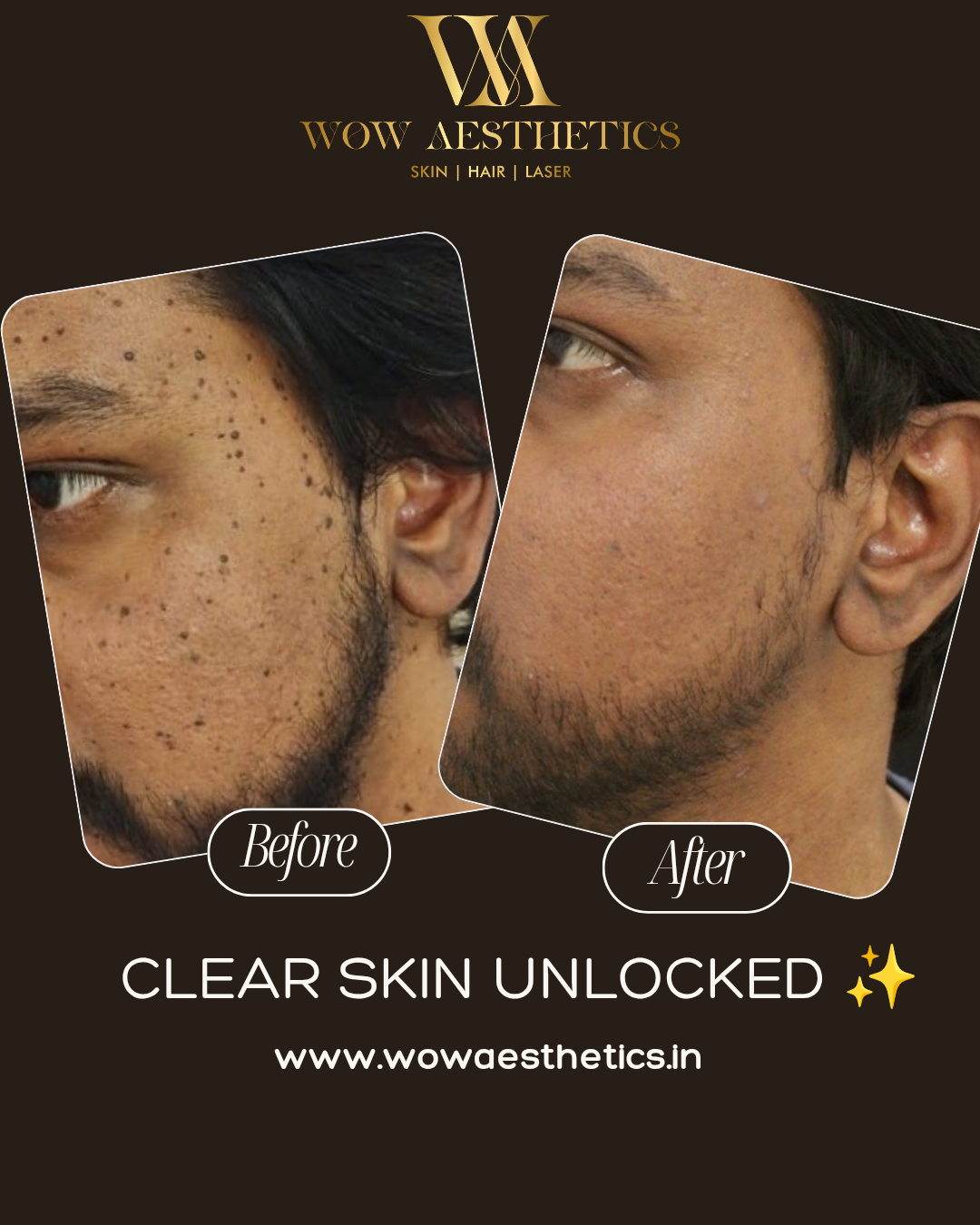 Dark Brown and White Typographic Skincare Treatment Instagram Post_20251128_153010_0000