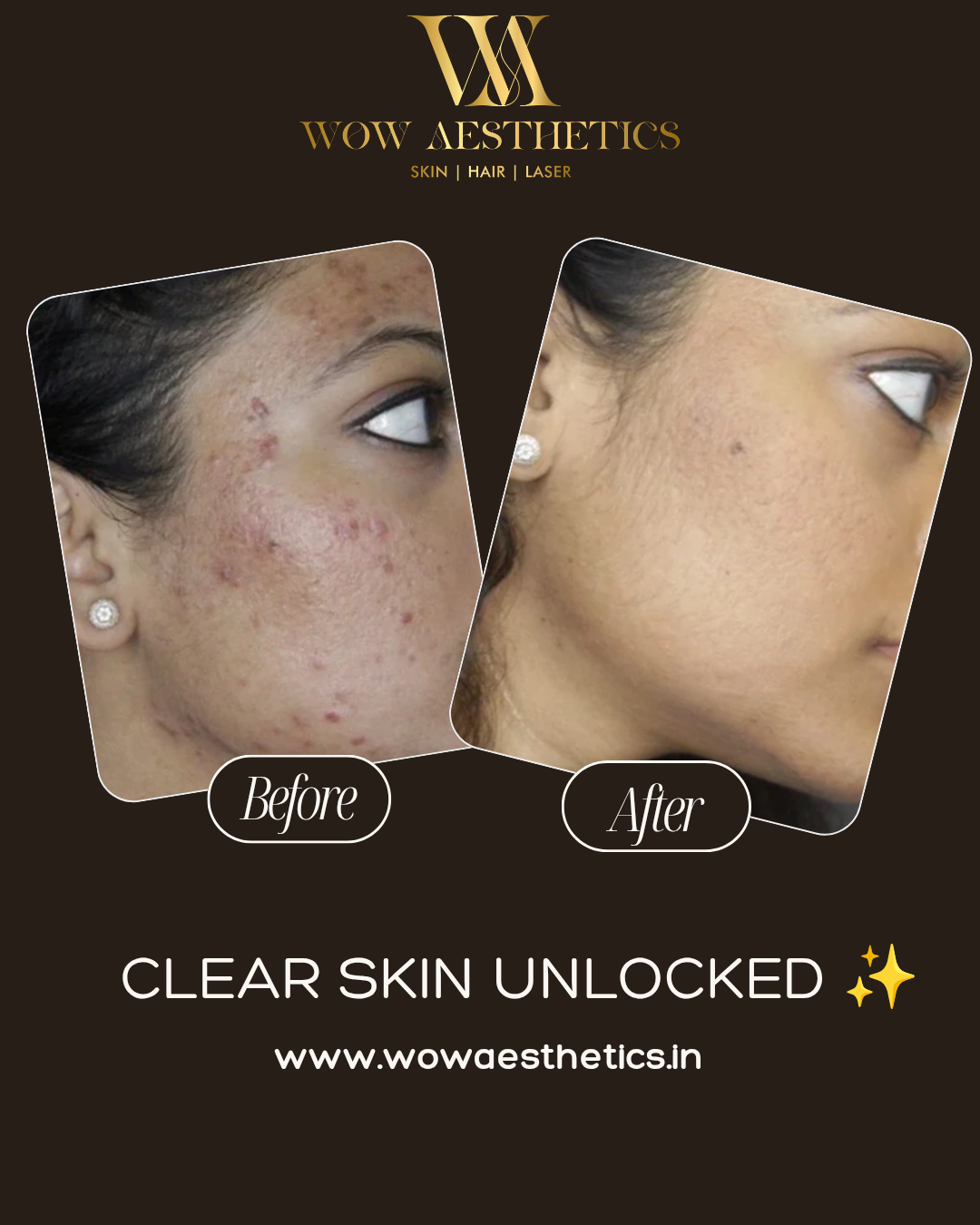 Dark Brown and White Typographic Skincare Treatment Instagram Post_20251128_153140_0000