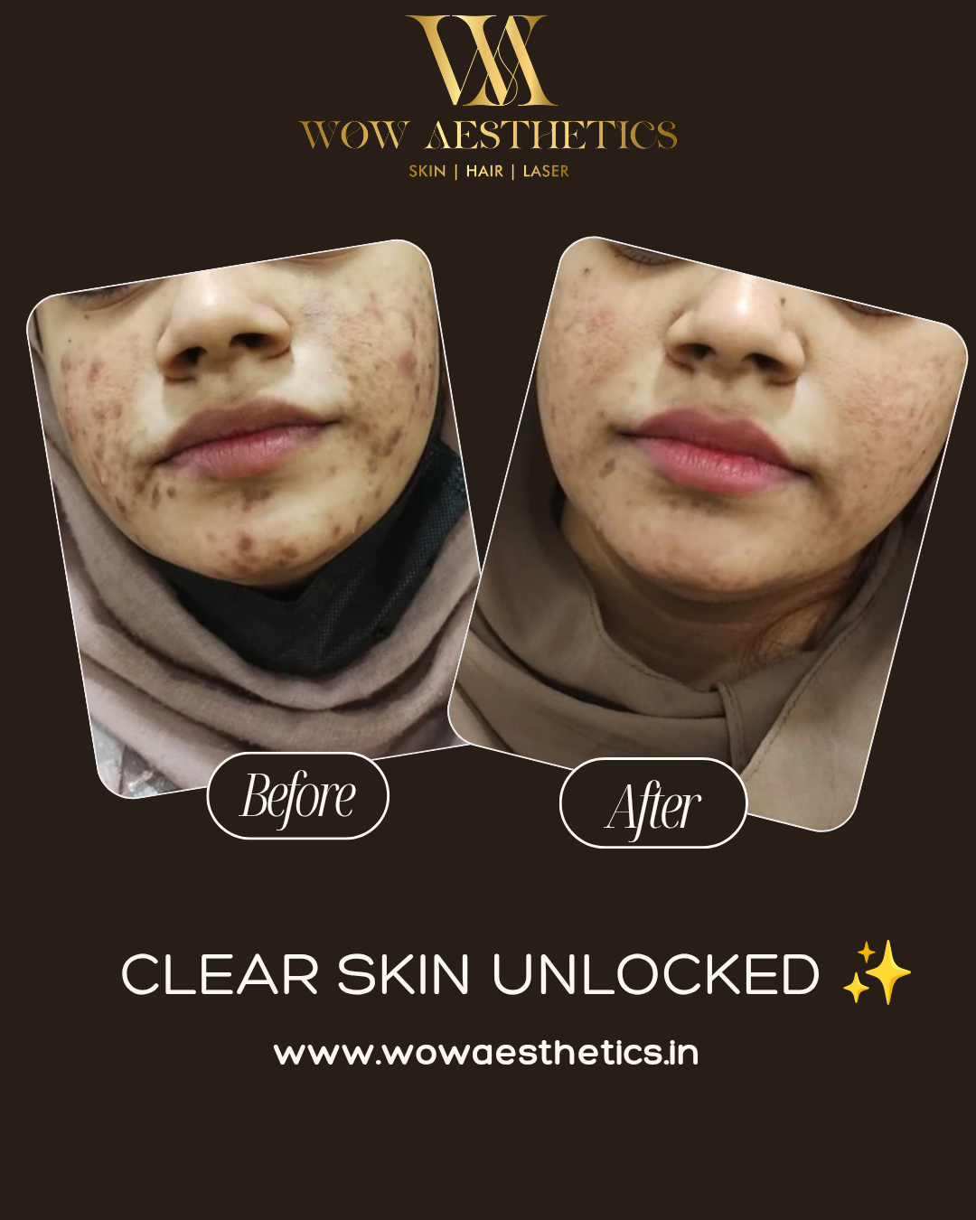 Dark Brown and White Typographic Skincare Treatment Instagram Post_20251128_153417_0000