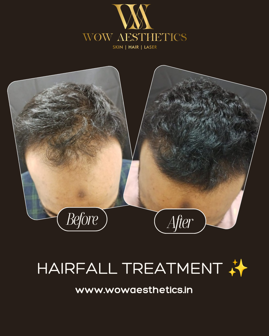 Dark Brown and White Typographic Skincare Treatment Instagram Post_20251128_153524_0000