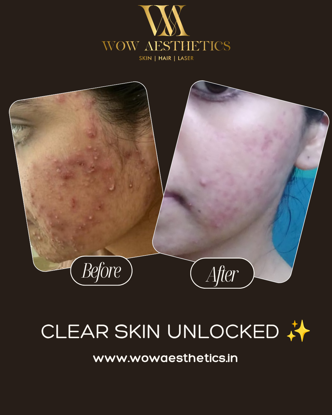 Dark Brown and White Typographic Skincare Treatment Instagram Post_20251128_153753_0000