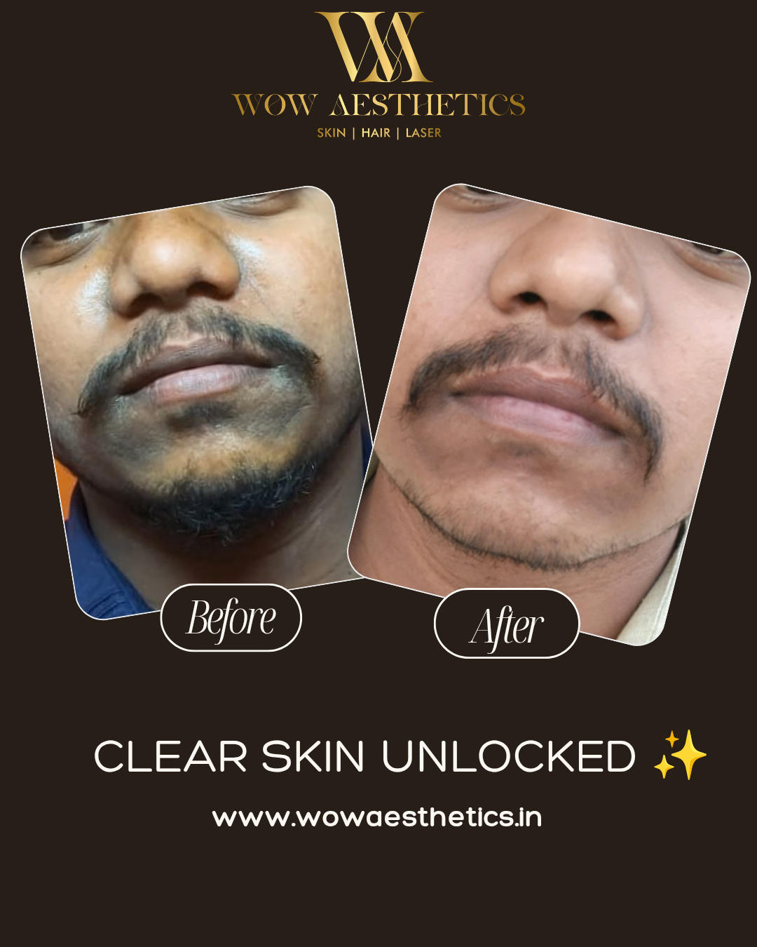 Dark Brown and White Typographic Skincare Treatment Instagram Post_20251128_153923_0000