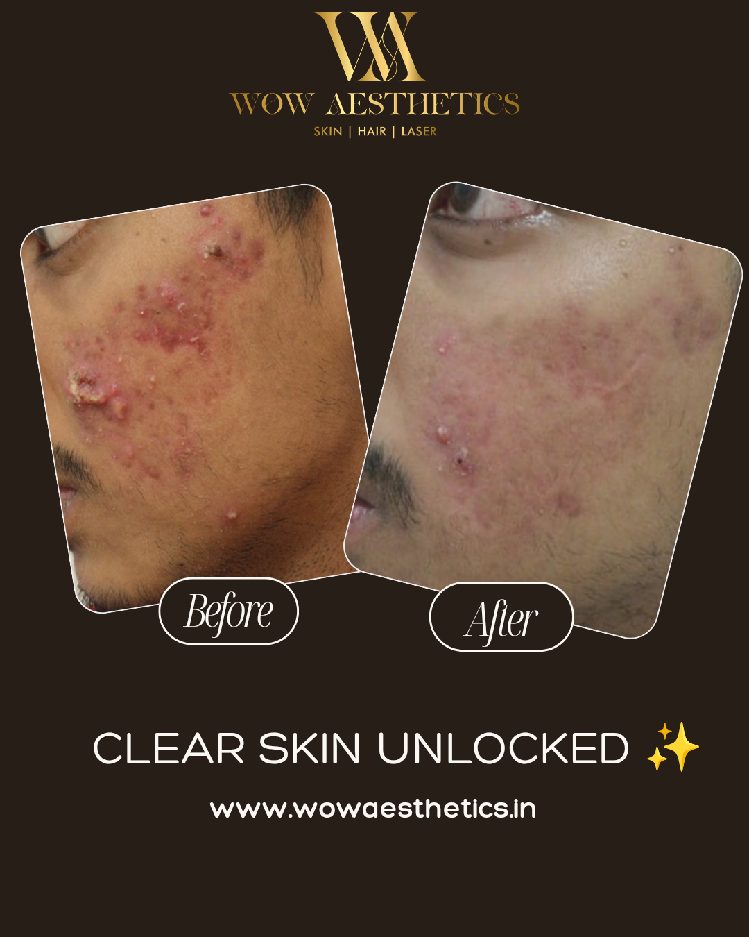 Dark Brown and White Typographic Skincare Treatment Instagram Post_20251128_160202_0000